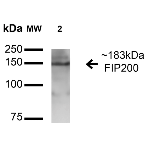 RB1CC1 / CC1 Antibody - Western blot analysis of Human HEK293Trap cell lysates showing detection of 183 kDa FIP200 protein using Rabbit Anti-FIP200 Polyclonal Antibody. Lane 1: Molecular Weight Ladder (MW). Lane 2: Human 293Trap. Load: 15 µg. Block: 5% Skim Milk in 1X TBST. Primary Antibody: Rabbit Anti-FIP200 Polyclonal Antibody  at 1:1000 for 1 hour at RT. Secondary Antibody: Goat Anti-Rabbit HRP at 1:2000 for 60 min at RT. Color Development: ECL solution for 6 min in RT. Predicted/Observed Size: 183 kDa.