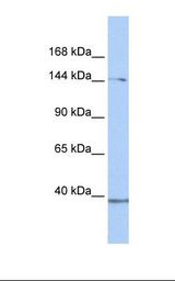 RB1CC1 / CC1 Antibody - 293T cell lysate. Antibody concentration: 1.0 ug/ml. Gel concentration: 6-18%.  This image was taken for the unconjugated form of this product. Other forms have not been tested.