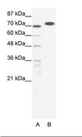 RBAK Antibody - A: Marker, B: HepG2 Cell Lysate.  This image was taken for the unconjugated form of this product. Other forms have not been tested.