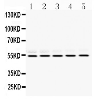 RBBP4 / RBAP48 Antibody - RbAp48 antibody Western blot. All lanes: Anti RbAp48 at 0.5 ug/ml. Lane 1: Rat Brain Tissue Lysate at 50 ug. Lane 2: Mouse Liver Tissue Lysate at 50 ug. Lane 3: Mouse Lung Tissue Lysate at 50 ug. Lane 4: HELA Whole Cell Lysate at 40 ug. Lane 5: JURKAT Whole Cell Lysate at 40 ug. Predicted band size: 54 kD. Observed band size: 54 kD.