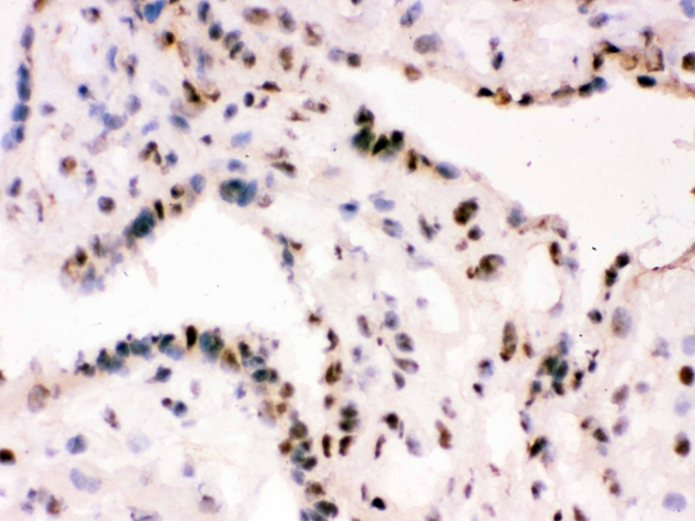 RBBP4 / RBAP48 Antibody - IHC analysis of RbAp48 using anti-RbAp48 antibody. RbAp48 was detected in frozen section of human placenta tissue . Heat mediated antigen retrieval was performed in citrate buffer (pH6, epitope retrieval solution) for 20 mins. The tissue section was blocked with 10% goat serum. The tissue section was then incubated with 1µg/ml rabbit anti-RbAp48 Antibody overnight at 4°C. Biotinylated goat anti-rabbit IgG was used as secondary antibody and incubated for 30 minutes at 37°C. The tissue section was developed using Strepavidin-Biotin-Complex (SABC) with DAB as the chromogen.