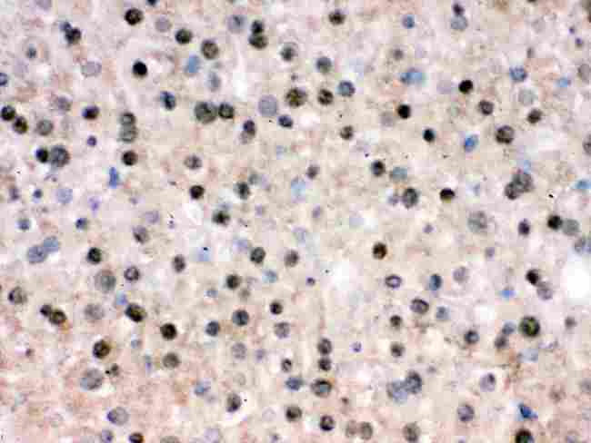 RBBP4 / RBAP48 Antibody - IHC analysis of RbAp48 using anti-RbAp48 antibody. RbAp48 was detected in frozen section of mouse liver tissue . Heat mediated antigen retrieval was performed in citrate buffer (pH6, epitope retrieval solution) for 20 mins. The tissue section was blocked with 10% goat serum. The tissue section was then incubated with 1µg/ml rabbit anti-RbAp48 Antibody overnight at 4°C. Biotinylated goat anti-rabbit IgG was used as secondary antibody and incubated for 30 minutes at 37°C. The tissue section was developed using Strepavidin-Biotin-Complex (SABC) with DAB as the chromogen.