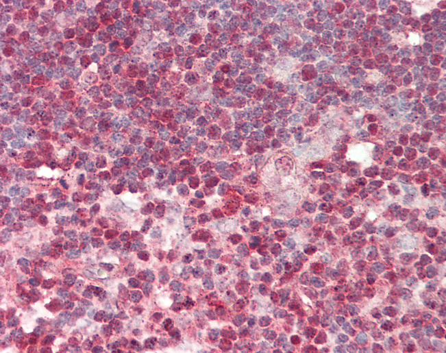 RBBP4 / RBAP48 Antibody - Human Thymus: Formalin-Fixed, Paraffin-Embedded (FFPE).  This image was taken for the unconjugated form of this product. Other forms have not been tested.