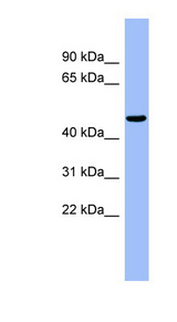 RBBP4 / RBAP48 Antibody - RBBP4 / RBAP48 antibody Western blot of Fetal Muscle lysate. This image was taken for the unconjugated form of this product. Other forms have not been tested.