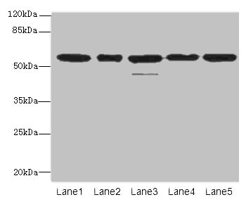 RBBP4 / RBAP48 Antibody - Western blot All lanes: RBBP4 antibody at 1µg/ml Lane 1: Hela whole cell lysate Lane 2: LO2 whole cell lysate Lane 3: K562 whole cell lysate Lane 4: NIH/3T3 whole cell lysate Lane 5: Raji whole cell lysate Secondary Goat polyclonal to rabbit IgG at 1/10000 dilution Predicted band size: 48, 47, 44 kDa Observed band size: 48, 55 kDa