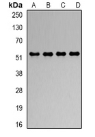RBBP4 / RBAP48 Antibody - Western blot analysis of RbAp48 expression in HeLa (A); Jurkat (B); NIH3T3 (C); COS7 (D) whole cell lysates.