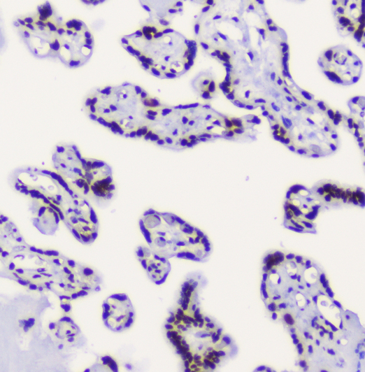 RBBP4 / RBAP48 Antibody - IHC analysis of RbAp48 using anti-RbAp48 antibody. RbAp48 was detected in paraffin-embedded section of human placenta tissue . Heat mediated antigen retrieval was performed in citrate buffer (pH6, epitope retrieval solution) for 20 mins. The tissue section was blocked with 10% goat serum. The tissue section was then incubated with 2µg/ml mouse anti-RbAp48 antibody overnight at 4°C. Biotinylated goat anti-mouse IgG was used as secondary antibody and incubated for 30 minutes at 37°C. The tissue section was developed using Strepavidin-Biotin-Complex (SABC) with DAB as the chromogen.