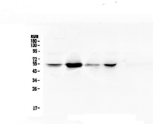 RBBP4 / RBAP48 Antibody - Western blot analysis of RbAp48 using anti-RbAp48 antibody. Electrophoresis was performed on a 10% SDS-PAGE gel at 70V (Stacking gel) / 90V (Resolving gel) for 2-3 hours. The sample well of each lane was loaded with 50ug of sample under reducing conditions. Lane 1: human A549 whole cell lysate,Lane 2: human Jurkat whole cell lysate,Lane 3: human Hela whole cell lysate,Lane 4: human PANC-1 whole cell lysate. After Electrophoresis, proteins were transferred to a Nitrocellulose membrane at 150mA for 50-90 minutes. Blocked the membrane with 5% Non-fat Milk/ TBS for 1.5 hour at RT. The membrane was incubated with mouse anti-RbAp48 antigen affinity purified monoclonal antibody at 0.5 µg/mL overnight at 4°C, then washed with TBS-0.1% Tween 3 times with 5 minutes each and probed with a goat anti-mouse IgG-HRP secondary antibody at a dilution of 1:10000 for 1.5 hour at RT. The signal is developed using an Enhanced Chemiluminescent detection (ECL) kit with Tanon 5200 system.