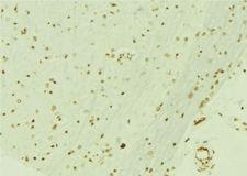 RBBP4 / RBAP48 Antibody - 1:100 staining mouse brain tissue by IHC-P. The sample was formaldehyde fixed and a heat mediated antigen retrieval step in citrate buffer was performed. The sample was then blocked and incubated with the antibody for 1.5 hours at 22°C. An HRP conjugated goat anti-rabbit antibody was used as the secondary.
