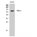 RBBP5 Antibody - Western blot of RBQ-3 antibody