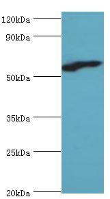 RBBP5 Antibody - Western blot. All lanes: Retinoblastoma-binding protein 5 antibody at 6 ug/ml+HepG2 whole cell lysate. Secondary antibody: Goat polyclonal to rabbit at 1:10000 dilution. Predicted band size: 59 kDa. Observed band size: 59 kDa.