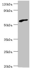 RBBP5 Antibody - Western blot All lanes: RBBP5 antibody at 6µg/ml + HepG2 whole cell lysate Secondary Goat polyclonal to rabbit IgG at 1/10000 dilution Predicted band size: 60, 56 kDa Observed band size: 60 kDa