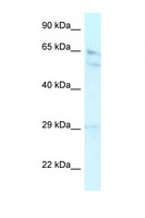 RBBP5 Antibody - RBBP5 antibody Western blot of HepG2 Cell lysate. Antibody concentration 1 ug/ml. This image was taken for the unconjugated form of this product. Other forms have not been tested.