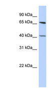 RBBP5 Antibody - RBBP5 antibody Western blot of HepG2 cell lysate. This image was taken for the unconjugated form of this product. Other forms have not been tested.