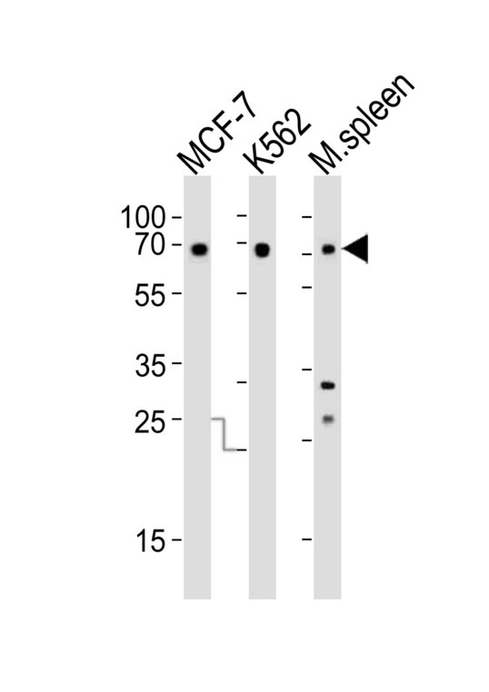 RBBP5 Antibody - Western blot of lysates from MCF-7, K562 cell line and mouse spleen tissue (from left to right) with RBBP5 Antibody. Antibody was diluted at 1:1000 at each lane. A goat anti-rabbit IgG H&L (HRP) at 1:10000 dilution was used as the secondary antibody. Lysates at 20 ug per lane.