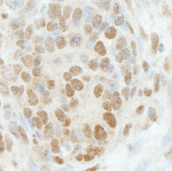 RBBP5 Antibody - Detection of Mouse RbBP5 by Immunohistochemistry. Sample: FFPE section of mouse teratoma. Antibody: Affinity purified rabbit anti-RbBP5 used at a dilution of 1:250.