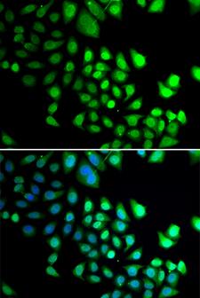 RBBP5 Antibody - Immunofluorescence analysis of U20S cells.