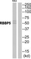 RBBP5 Antibody - Western blot of extracts from CoLo cells, using RBBP5 antibody.