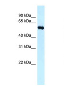 RBBP5 Antibody - RBBP5 antibody Western blot of Mouse Kidney lysate. Antibody concentration 1 ug/ml.  This image was taken for the unconjugated form of this product. Other forms have not been tested.