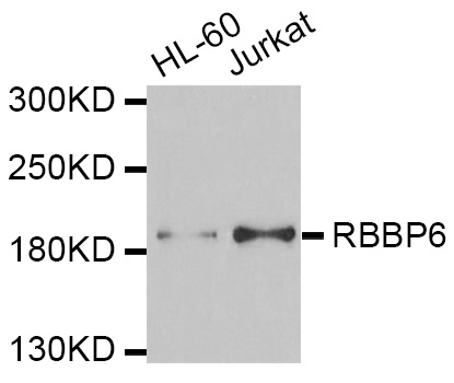 RBBP6 Antibody - Western blot analysis of extracts of various cell lines.