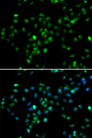 RBBP6 Antibody - Immunofluorescence analysis of MCF7 cells.