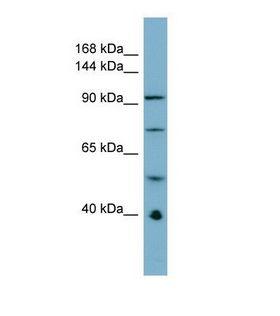 RBBP6 Antibody - Western blot of Human ACHN Whole cell . RBBP6 antibody dilution 1.0 ug/ml.  This image was taken for the unconjugated form of this product. Other forms have not been tested.