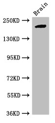 RBBP6 Antibody - Positive WB detected in:Mouse brain tissue;All lanes:RBBP6 antibody at 2.7?g/ml;Secondary;Goat polyclonal to rabbit IgG at 1/50000 dilution;Predicted band size: 202,198,14,107 KDa;Observed band size: 202 KDa;