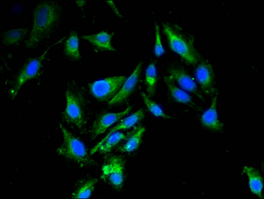 RBBP6 Antibody - Immunofluorescent analysis of Hela cells using RBBP6 Antibody at a dilution of 1:100 and Alexa Fluor 488-congugated AffiniPure Goat Anti-Rabbit IgG(H+L)