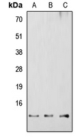 RBBP6 Antibody - Western blot analysis of RBBP6 expression in HEK293T (A); Raw264.7 (B); H9C2 (C) whole cell lysates.
