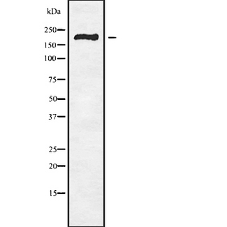 RBBP6 Antibody - Western blot analysis of RBBP6 using HuvEc whole cells lysates