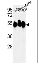 RBBP7 / RbAp46 Antibody - Western blot of RBBP7 Antibody in HeLa, MDA-MB231, 293 cell line lysates (35 ug/lane). RBBP7 (arrow) was detected using the purified antibody.
