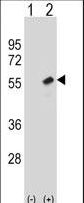RBBP7 / RbAp46 Antibody - Western blot of RBBP7 (arrow) using rabbit polyclonal RBBP7 Antibody. 293 cell lysates (2 ug/lane) either nontransfected (Lane 1) or transiently transfected (Lane 2) with the RBBP7 gene.
