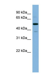 RBBP7 / RbAp46 Antibody - RBBP7 / RbAp46 antibody Western blot of Fetal Thymus lysate. This image was taken for the unconjugated form of this product. Other forms have not been tested.