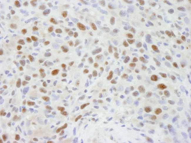 RBBP7 / RbAp46 Antibody - Detection of Mouse RBBP7 by Immunohistochemistry. Sample: FFPE section of mouse squamous cell carcinoma. Antibody: Affinity purified rabbit anti-RBBP7 used at a dilution of 1:250.