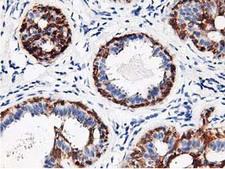 RBBP7 / RbAp46 Antibody - IHC of paraffin-embedded Human breast tissue using anti-RBBP7 mouse monoclonal antibody. (Heat-induced epitope retrieval by 10mM citric buffer, pH6.0, 100C for 10min).