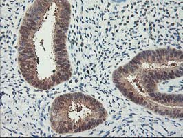RBBP7 / RbAp46 Antibody - IHC of paraffin-embedded Human endometrium tissue using anti-RBBP7 mouse monoclonal antibody.