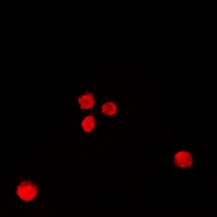 RBBP7 / RbAp46 Antibody - Immunofluorescent analysis of RbAp46 staining in MCF7 cells. Formalin-fixed cells were permeabilized with 0.1% Triton X-100 in TBS for 5-10 minutes and blocked with 3% BSA-PBS for 30 minutes at room temperature. Cells were probed with the primary antibody in 3% BSA-PBS and incubated overnight at 4 deg C in a humidified chamber. Cells were washed with PBST and incubated with a DyLight 594-conjugated secondary antibody (red) in PBS at room temperature in the dark.