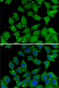 RBBP7 / RbAp46 Antibody - Immunofluorescence analysis of MCF7 cells using RBBP7 antibody. Blue: DAPI for nuclear staining.
