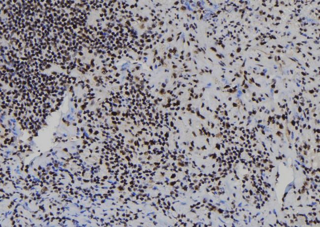 RBBP7 / RbAp46 Antibody - 1:100 staining human spleen tissue by IHC-P. The sample was formaldehyde fixed and a heat mediated antigen retrieval step in citrate buffer was performed. The sample was then blocked and incubated with the antibody for 1.5 hours at 22°C. An HRP conjugated goat anti-rabbit antibody was used as the secondary.