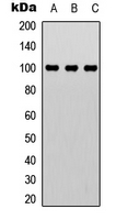 RBBP8 / CTIP Antibody - Western blot analysis of CTIP expression in MCF7 (A); Jurkat (B); HeLa (C) whole cell lysates.