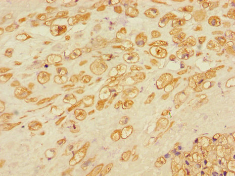 RBBP8 / CTIP Antibody - Immunohistochemistry of paraffin-embedded human placental tissue using RBBP8 Antibody at dilution of 1:100