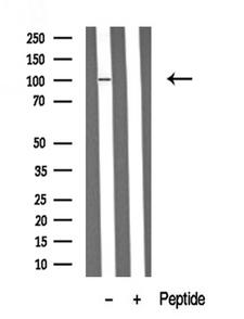 RBBP8 / CTIP Antibody - Western blot analysis of extracts of mouse brain tissue sample using RBBP8 antibody.