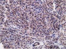 RBBP9 Antibody - Immunohistochemical staining of paraffin-embedded Human pancreas tissue using anti-RBBP9 mouse monoclonal antibody. (Dilution 1:50).