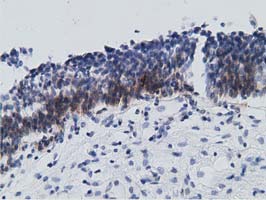 RBBP9 Antibody - Immunohistochemical staining of paraffin-embedded Human bladder tissue using anti-RBBP9 mouse monoclonal antibody. (Dilution 1:50).
