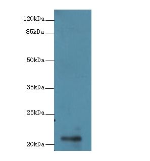 RBBP9 Antibody - Western blot. All lanes: RBBP9 antibody at 1 ug/ml+ A375 whole cell lysate Goat polyclonal to rabbit at 1:10000 dilution. Predicted band size: 21 kDa. Observed band size: 21 kDa.