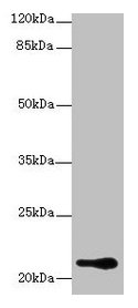 RBBP9 Antibody - Western blot All lanes: RBBP9 antibody at 1µg/ml + A375 whole cell lysate Secondary Goat polyclonal to rabbit IgG at 1/10000 dilution Predicted band size: 22, 20 kDa Observed band size: 22 kDa