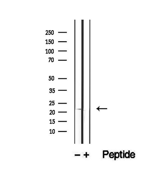 RBBP9 Antibody - Western blot analysis of extracts of A375 cells using RBBP9 antibody.