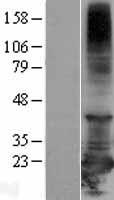 RBBP9 Protein - Western validation with an anti-DDK antibody * L: Control HEK293 lysate R: Over-expression lysate