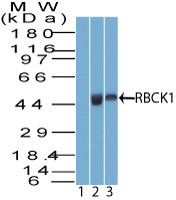 RBCK1 Antibody - Western Blot: RBCK1 Antibody - analysis of RBCK1 using RBCK1 antibody. A549 cell lysate in the 1) pre immune sera and 2) absence of immunizing peptide and 3) 3T3 cell lysate probed with 2 ug/ml of RBCK1 antibody. [Character a1]s goat anti-rabbit Ig HRP secondary antibody and PicoTect ECL substrate solution were used for this test.