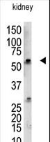 RBCK1 Antibody - The anti-UBCE7IP3 antibody is used in Western blot to detect UBCE7IP3 in mouse kidney tissue lysate.